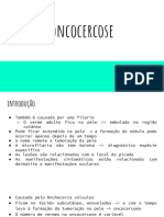 Oncocercose