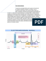 Que Es Un Electrocardiograma T5