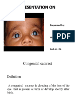 Congenital Cataract