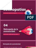 Retinopatía Prematura