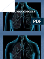 3 . AULA - Apresentação Pneumoconioses
