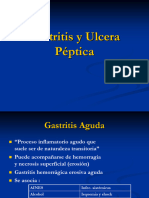 Gastritis y Ulcera Péptica, Tumores Gastricos