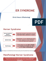 Horner Syndrome & Adies Tonik Pupil