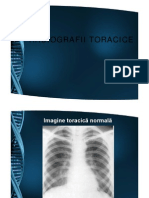 Radiografii_toracice