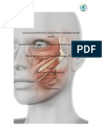 Paralisis Facial Idiopatica