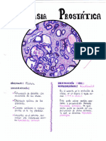 Hiperplasia Prostática - Dibujo