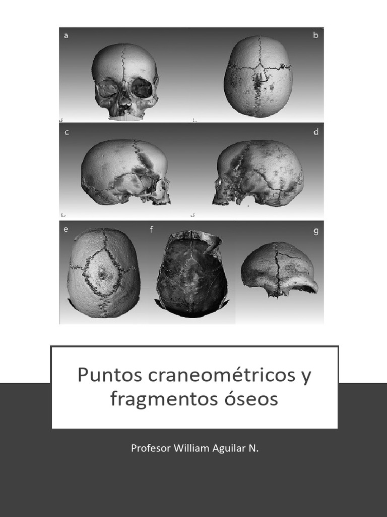 Puntos Craneométricos del Cráneo | PDF | Sistema esquelético | Cabeza y ...