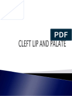 Cleft Lip and Palate