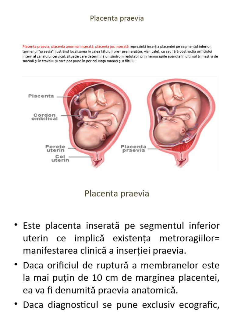 Placenta Praevia | PDF