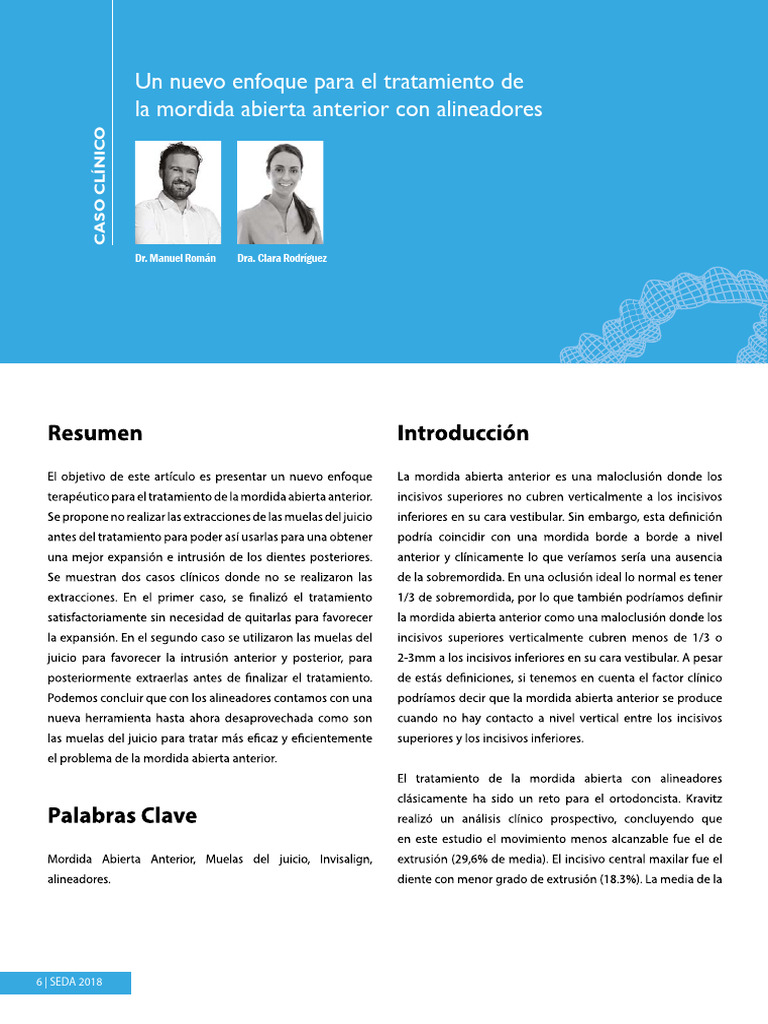 Image Result For Manejo Esttico De La Mordida Abierta Anterior Con Ortodoncia