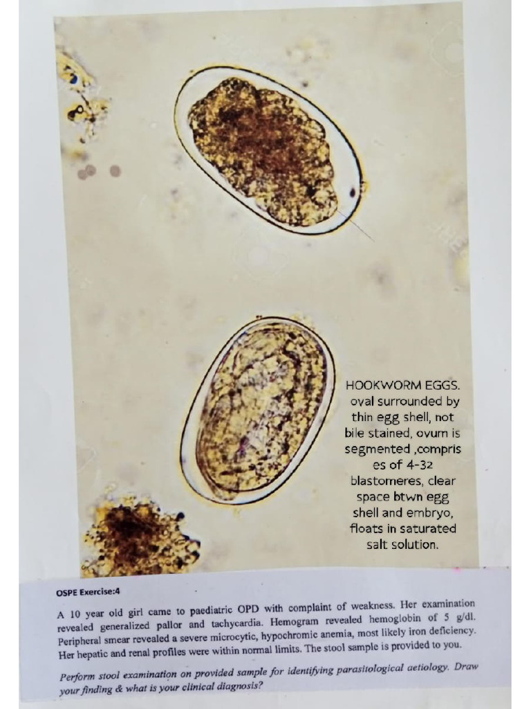 Micro Charts Stool Examination PDF