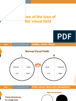 Visual Fields