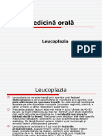 Leucoplazia