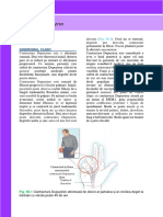 Contractura Dupuytren: Sindromul Clinic