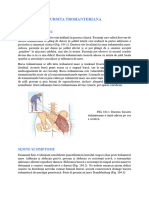 Bursita Trohanteriana: Sindromul Clinic