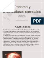 Trachoma y Quemaduras Corneales