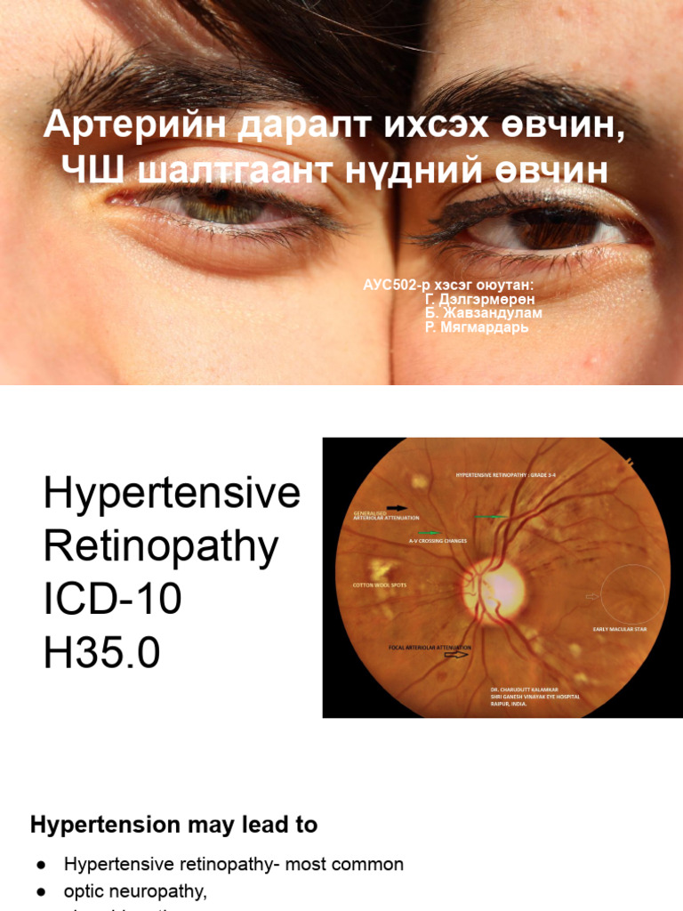 7. Артерийн даралт ихсэх өвчин | PDF | Hypertension | Ischemia