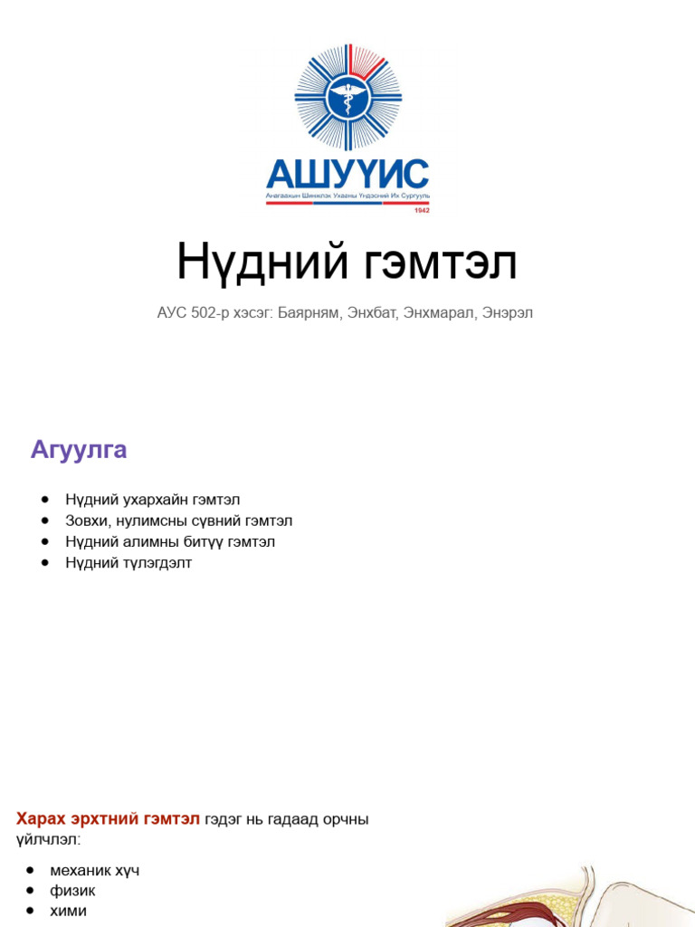 5. Нүдний гэмтэл | PDF