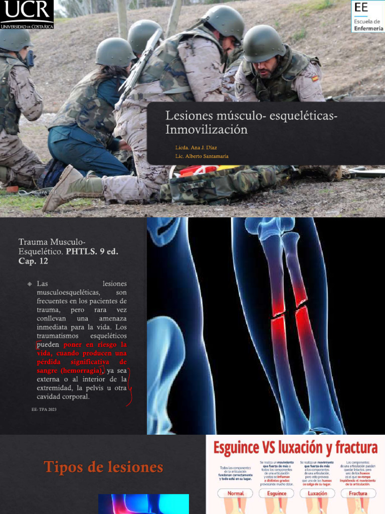 Lesiones Músculo - Esqueléticas - Inmovilización | PDF | Hueso ...