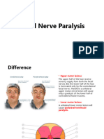 Facial Nerve Paralysis