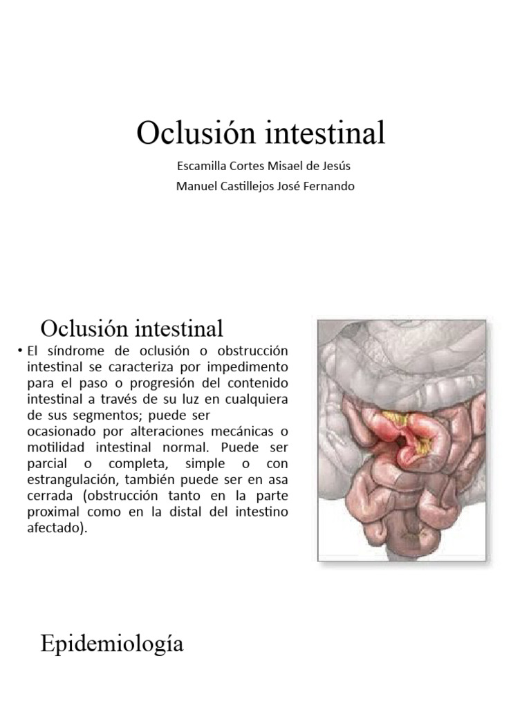 Oclusión Intestinal: Causas y Tratamiento | PDF