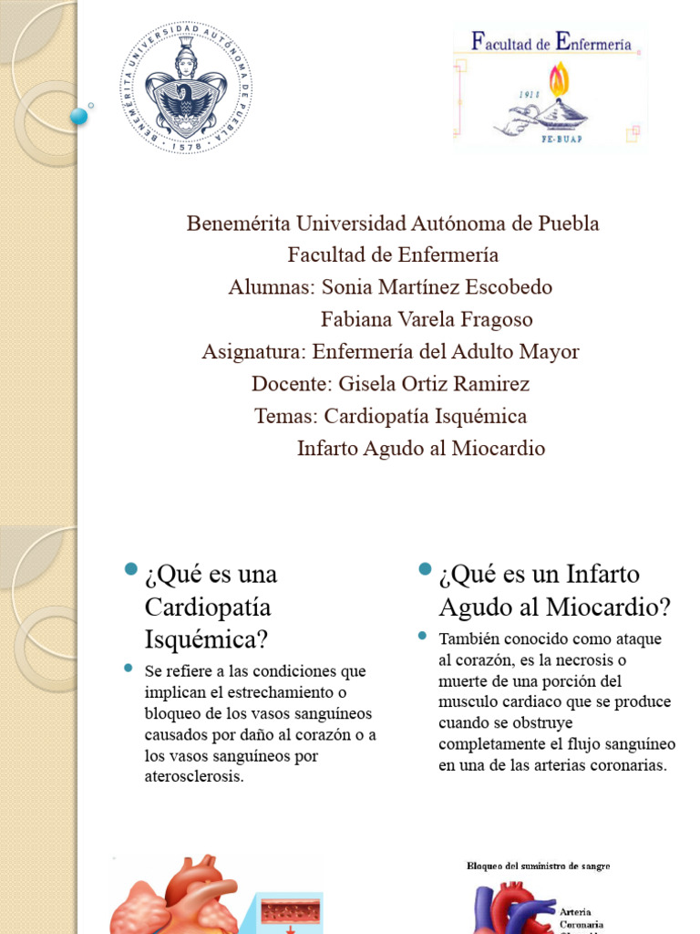 IAM Cardiopatia Isquemica Presentacion | PDF | Infarto de miocardio ...