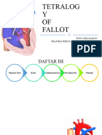 Tetralogy of Fallot
