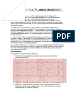 Miocardiopatia Arritmogénica