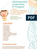 Developmental Anomalies of Tongue