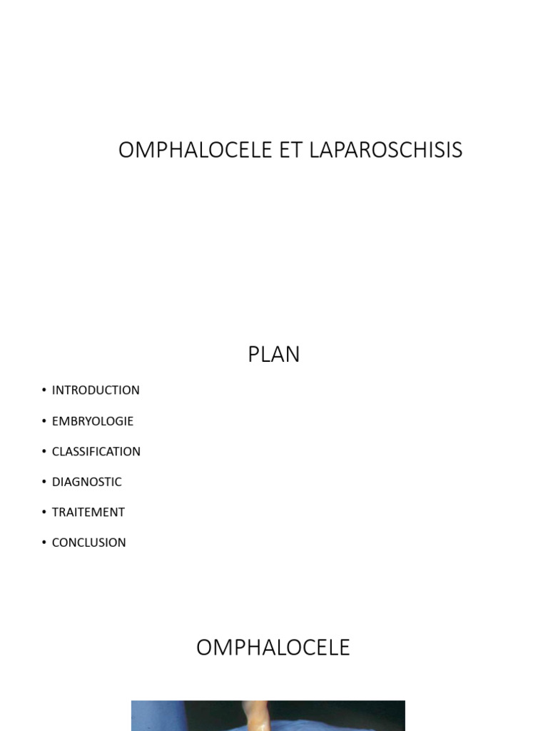 Classification Aitken : Omphalocèle et Laparoschisis | PDF | Nourrisson ...