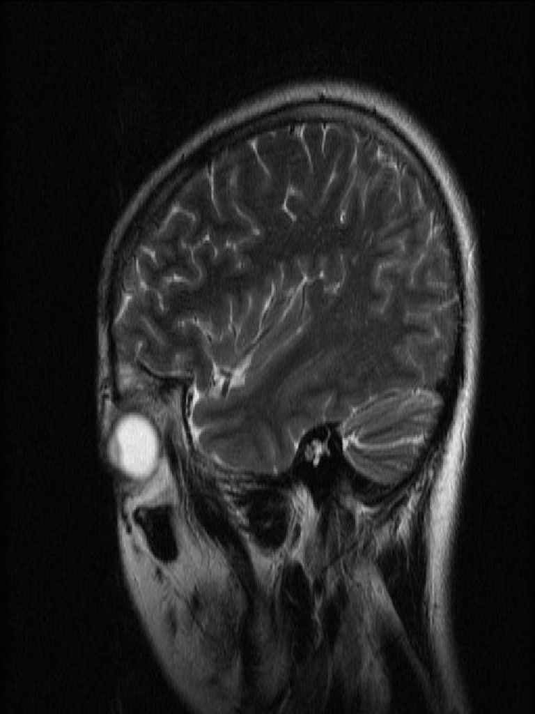 1.5T MRI Clinical Image | PDF