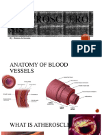 Atherosclerosis