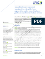 Immediate Implant Placement in Conjunction With Gu