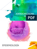 Adenocarcinoma de Colon