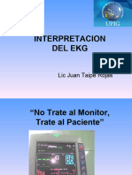 Interpretacion Del EKG