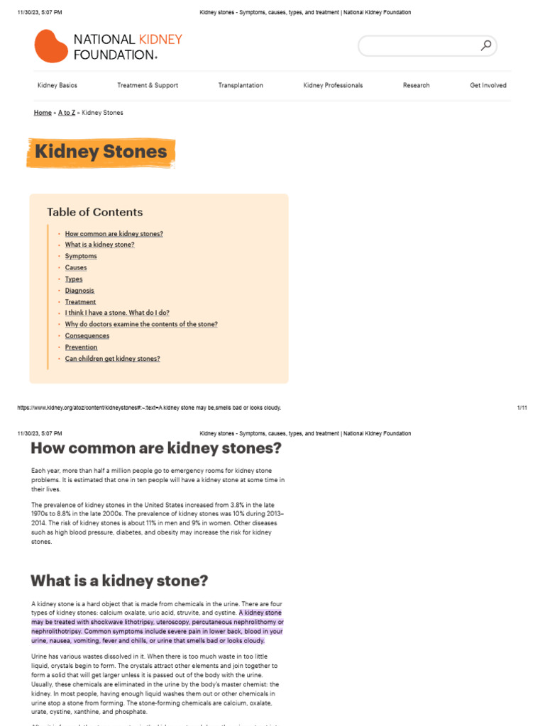 Kidney stones Symptoms, causes, types, and treatment _ National