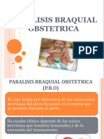 Paralisis Braquial Obstetrica