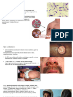 Leishmania