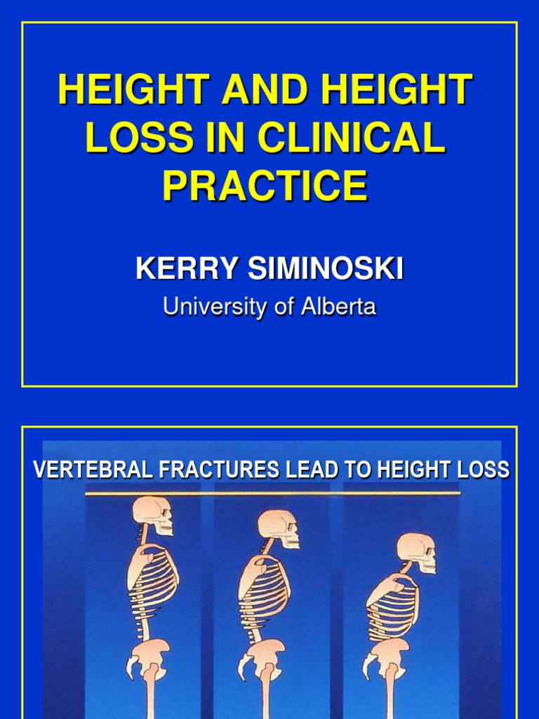 Height Loss and Its Impacts | PDF | Body Mass Index | Medical Specialties