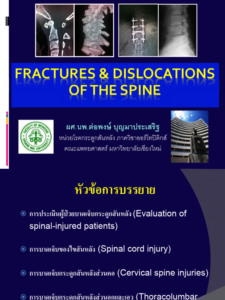 Fractures & Dislocations of The Spine (Medical Student V) | PDF