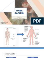 Tinea Capitis