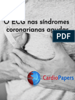 ECG Nas Síndromes Coronarianas Agudas