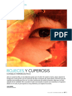 Rojeces: Y Cuperosis