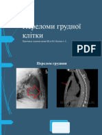 Переломи грудної клітки