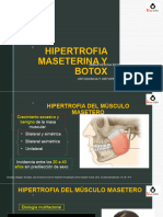 Hipertrofia Del Músculo Masetero