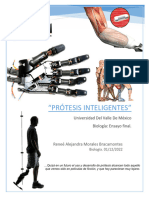 Protesis Inteligentes