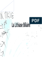 La Lithiase Biliaire+++++