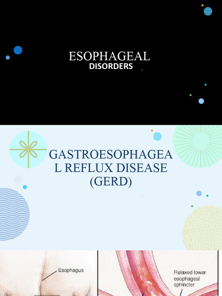 Gastroesophageal Reflux Disease Gerd 1 | PDF | Gastroesophageal Reflux ...