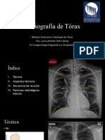 Radiografía de Tórax