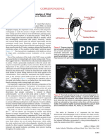 Pitfalls in The Echocardiographic Evaluation of Mi